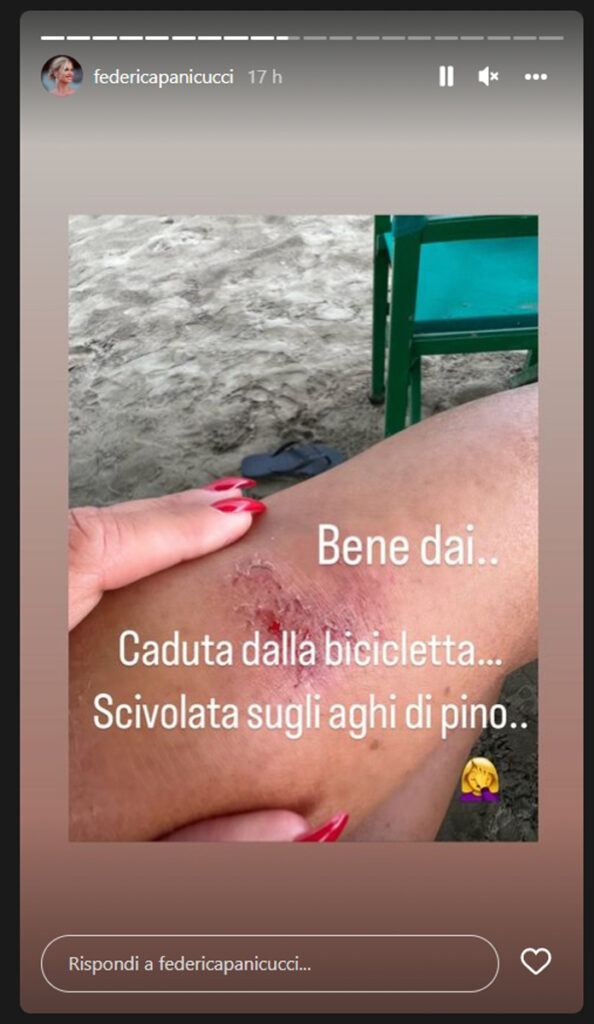 Federica Panicucci vittima di un incidente: "Mi sono sfasciata..", ecco cos