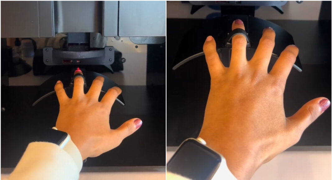 Intelligenza artificiale unghie