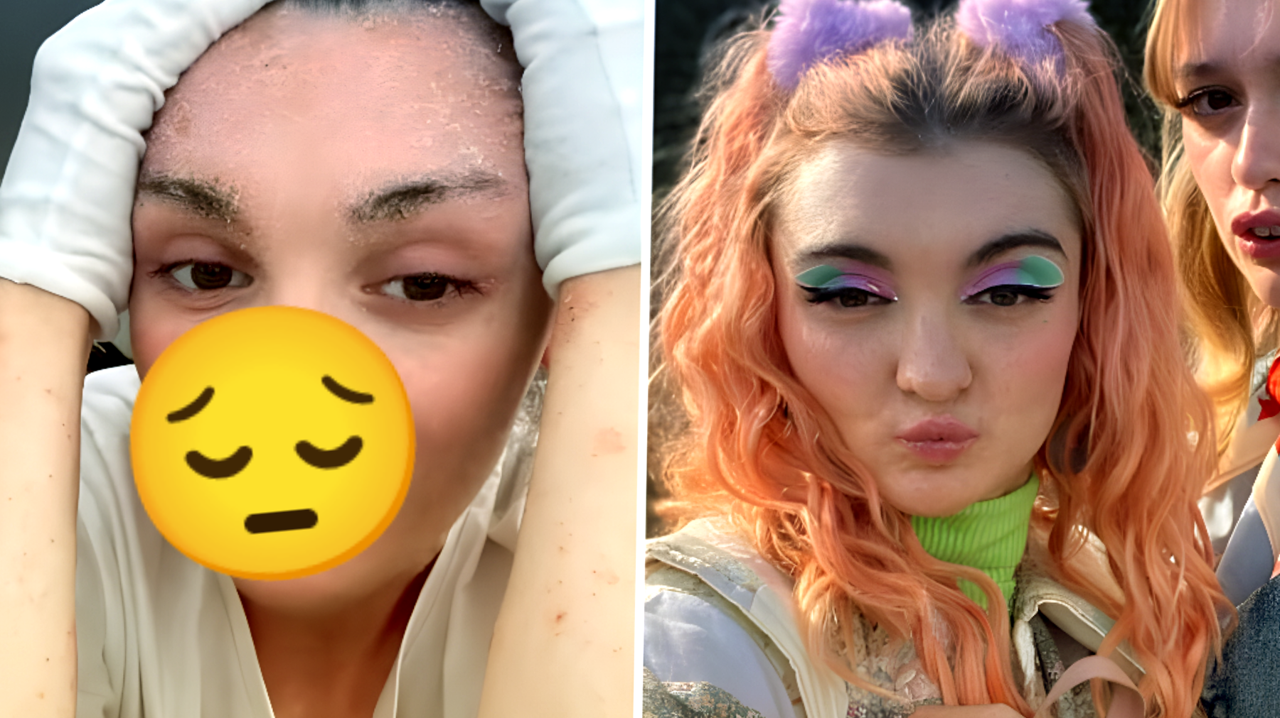 Anthony Lexa di "Sex Education" in preda al dolore: "Non riesco a fare niente". Un post sui social svela la spaventosa malattia